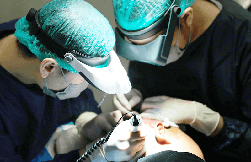 Hair Transplant