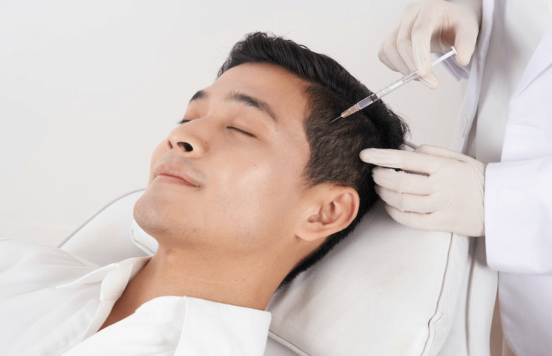 Alopecia Therapy