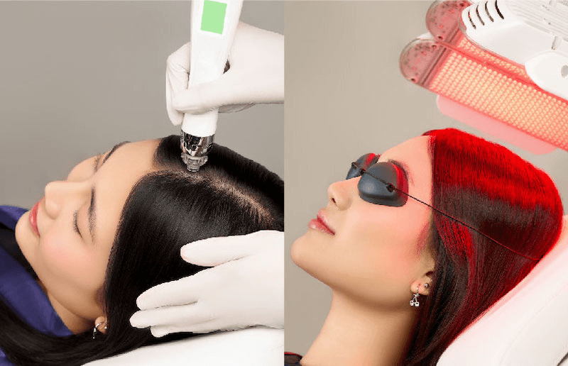 Advanced Anti Hair Fall Therapy