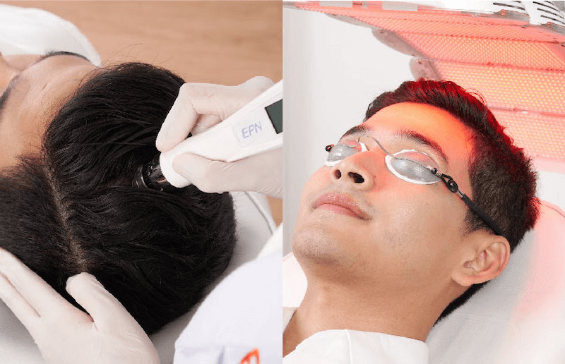Advanced Hair Grow Activation Therapy
